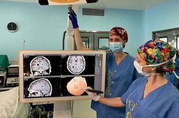 Neurocirugía opera una media de 150 tumores cerebrales al año